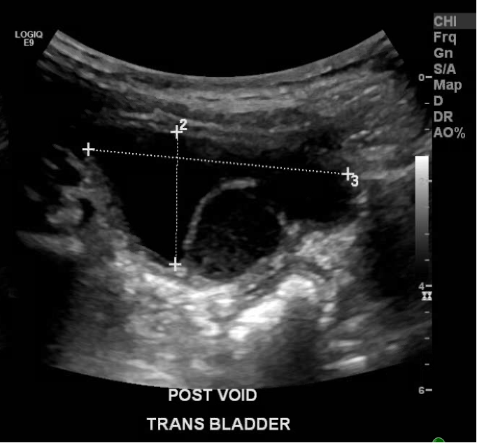 Urologic Emergencies - American Urological Association